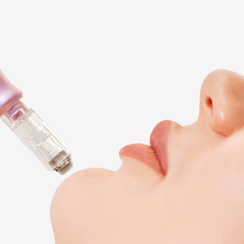 Microneedling